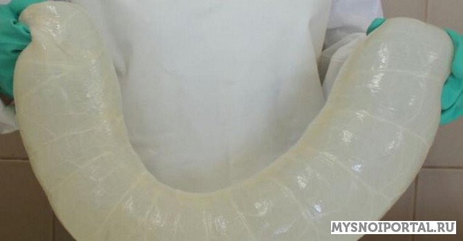 Cинюга говяжья Малоярославец - изображение 1